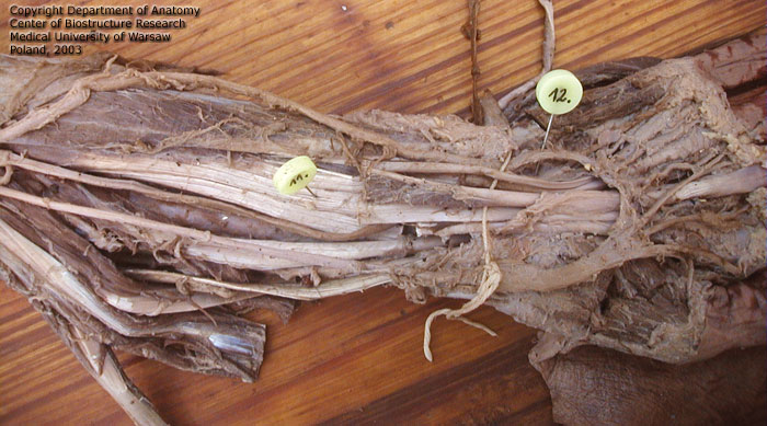 Szpilki -Grzbiet i kończyna górna - baz. m. flexor digitorum profundus dex.   12. a. ulnaris dex1.jpg